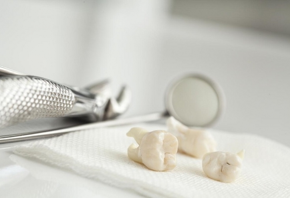 February 9 - International Day of Dentists