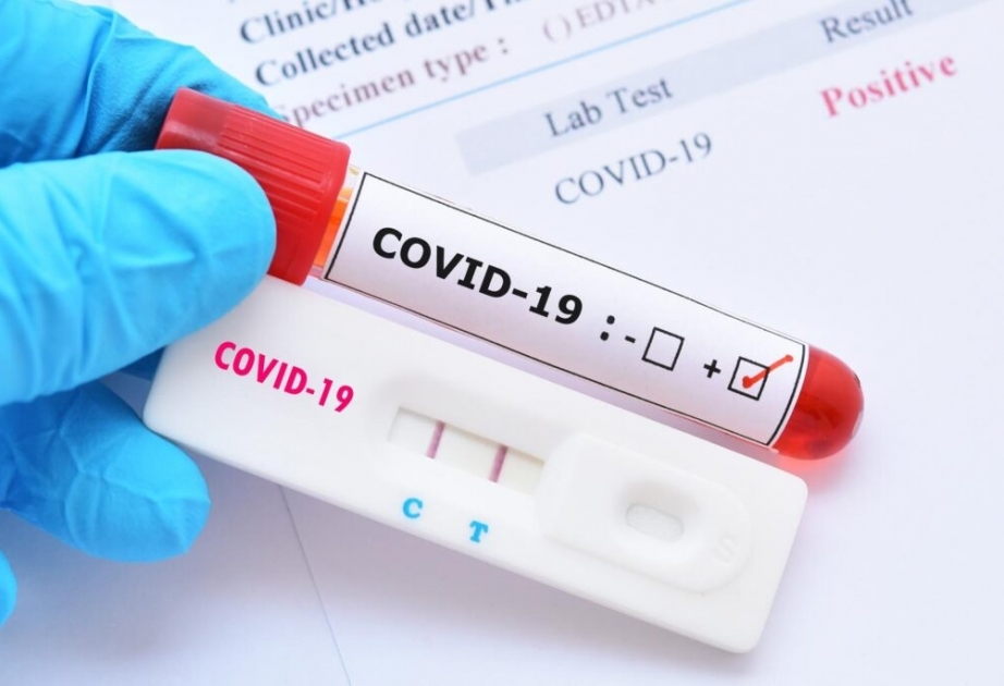 Coronavirus in Aserbaidschan: Bisher insgesamt 7.511.832 Corona-Tests durchgeführt