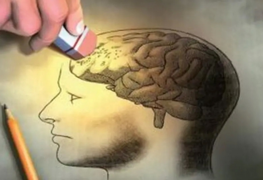 İsrail alimləri Alzheimer xəstəliyinin müalicəsində inqilabi kəşf ediblər