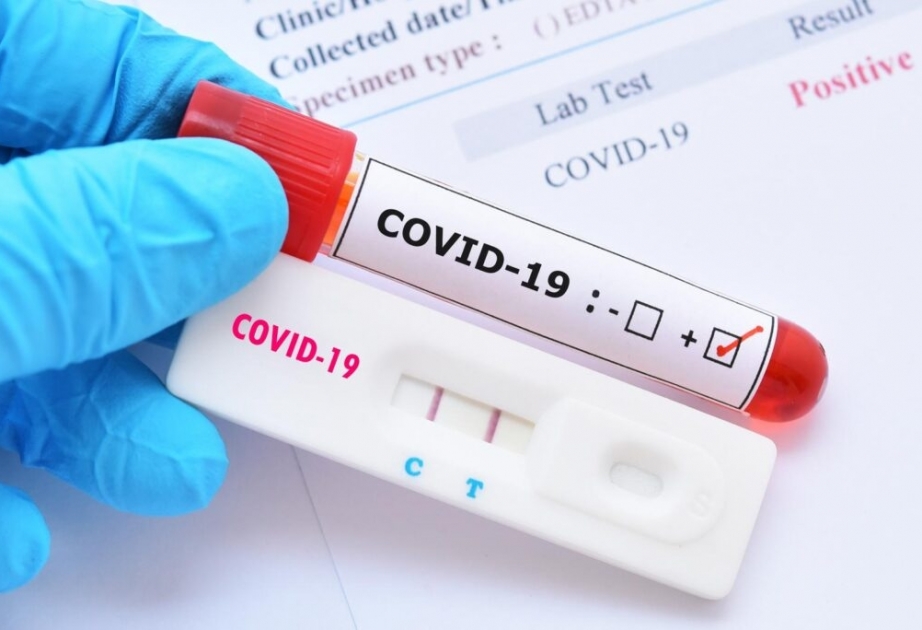 Coronavirus in Aserbaidschan: Seit Ausbruch der Pandemie wurden insgesamt 7.551.588 Corona-Tests durchgeführt