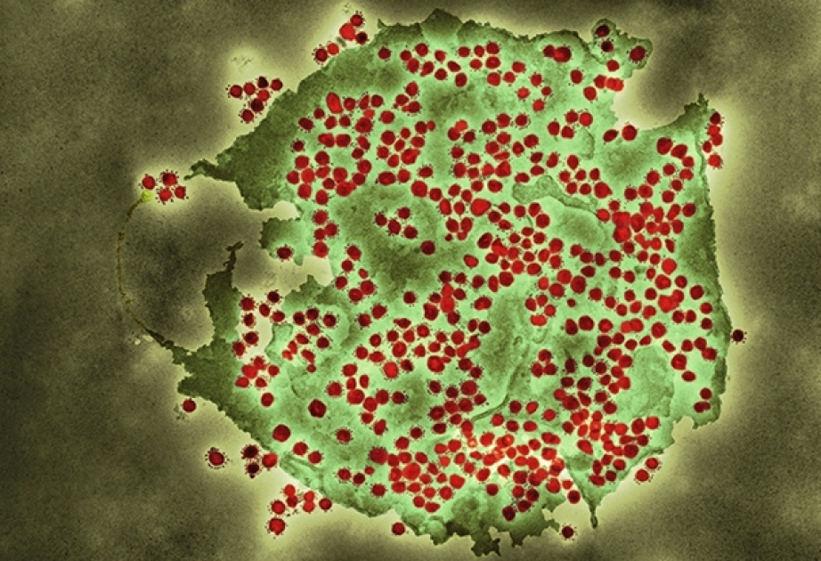 Coronavirus in Aserbaidschan: Mehr Infizierte, als Geheilte am Sonntag