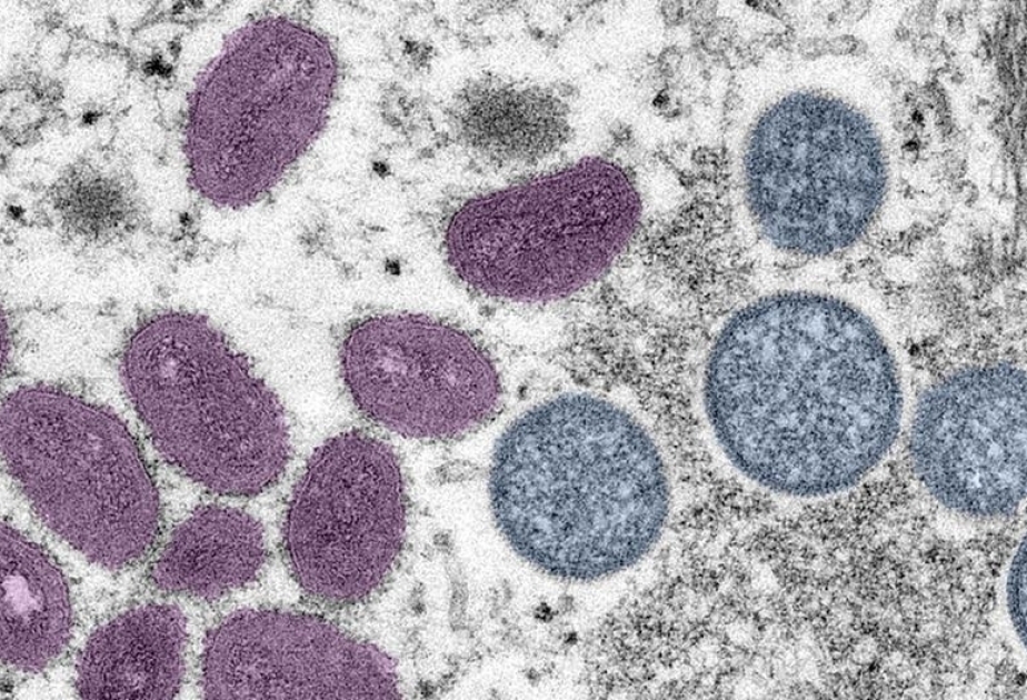 OMS : L’urgence de santé publique mpox est terminée