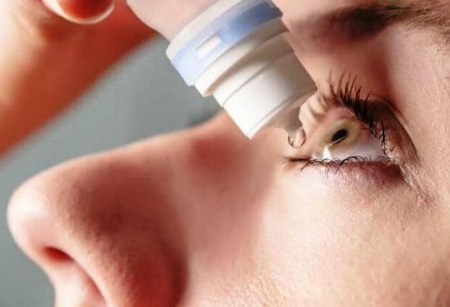 Quru göz sindromunun müalicəsində ən çox süni göz yaşı damcıları istifadə olunur