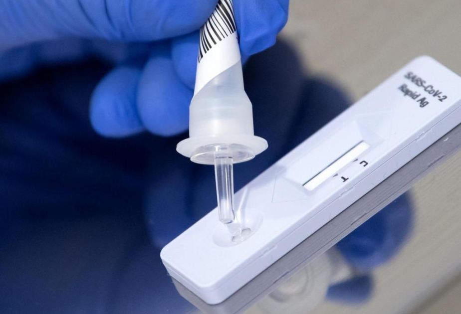 Coronavirus in Aserbaidschan: Bisher insgesamt 7.626.672 Corona-Tests durchgeführt