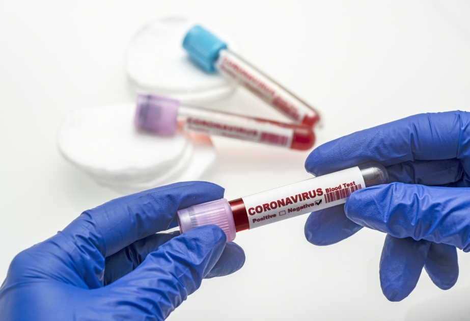 ÜST: Son bir ayda koronavirusa yoluxma halları 38 faiz azalıb