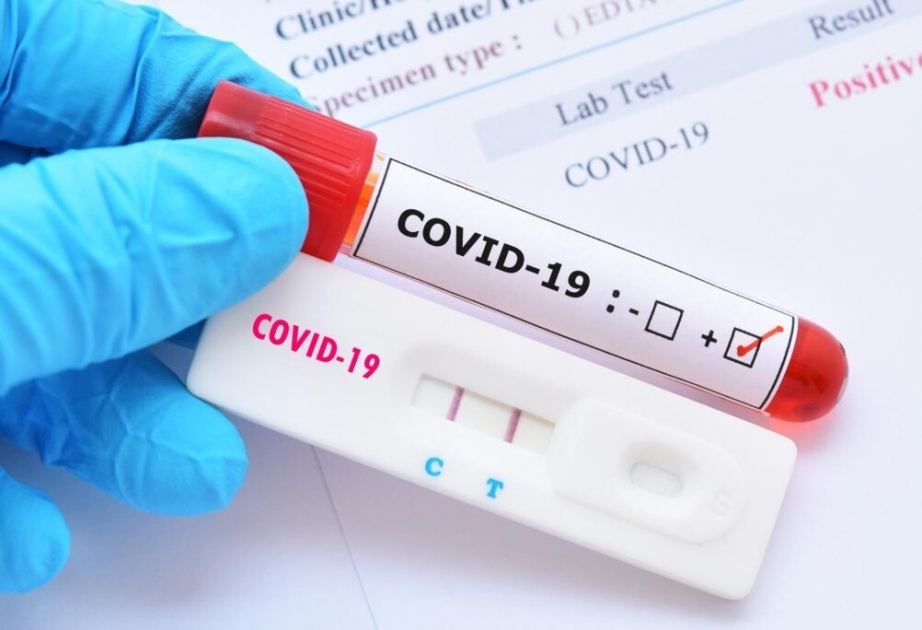 Coronavirus in Aserbaidschan: Bisher 7.640.012 Corona-Tests durchgeführt