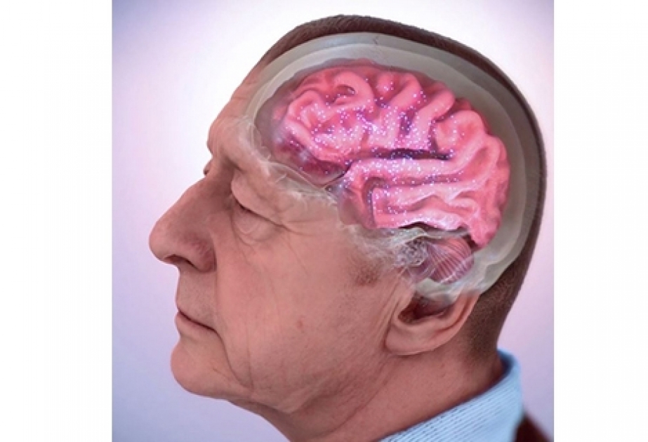FDA de EEUU aprueba Leqembi, medicamento contra Alzheimer