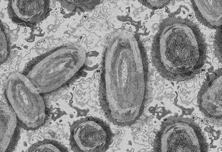 La OMS sigue la pista de una nueva variante del coronavirus EG.5