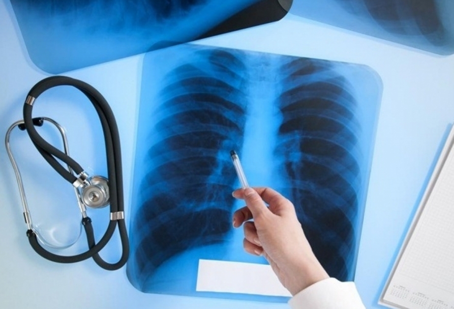 Se elogian los logros de los Estados miembros de la CEI en la lucha contra la tuberculosis