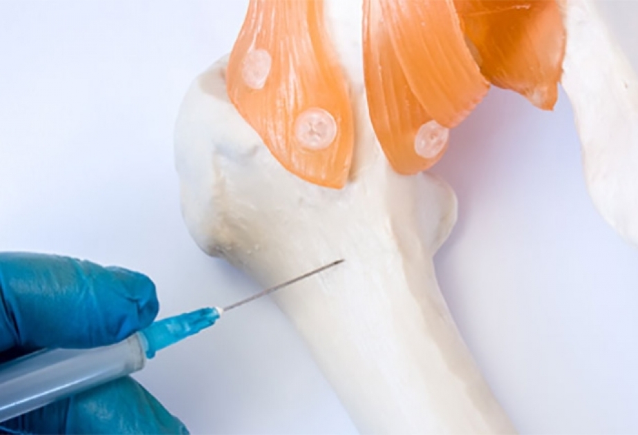 Milli Hematologiya və Transfuziologiya Mərkəzində sümük iliyi transplantasiyası əməliyyatı həyata keçirilir