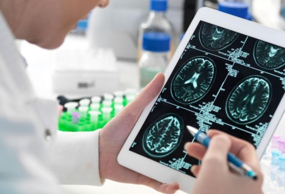 Alimlər Alzheimer xəstələrində beyin hüceyrələrinin hansı səbəbdən öldüyünü aşkar ediblər