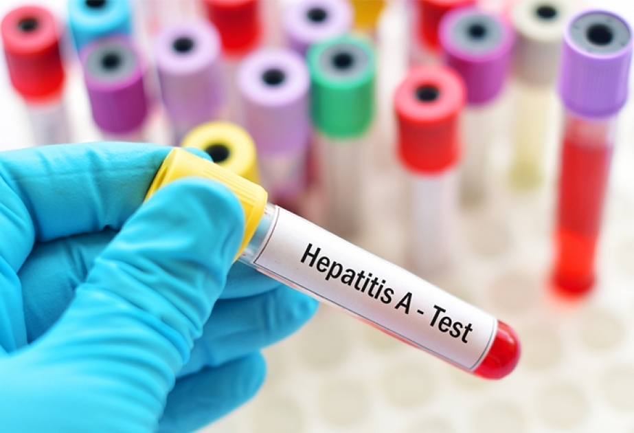 Səhiyyə Nazirliyi: Hepatit A infeksiyasına yoluxma hallarının sayında azalma var