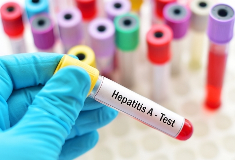 Ministerio de Sanidad: "Se observa un descenso en el número de casos de hepatitis A"