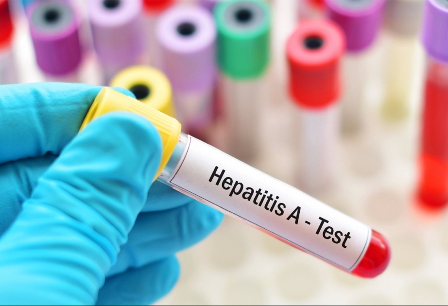 Hepatit B və C-dən fərqli olaraq, hepatit A xroniki qaraciyər xəstəliyinə səbəb olmur