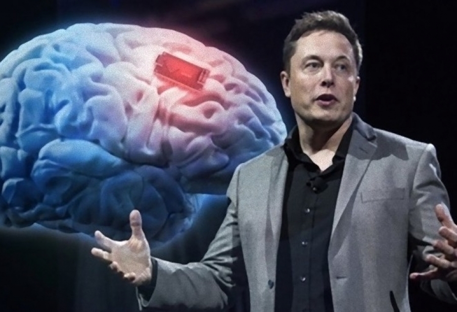 Neuralink implants brain chip in 1st human, says Elon Musk - AZERTAC