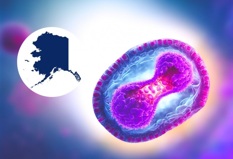 What is Alaskapox? Recent death brings attention to virus seen in small animals