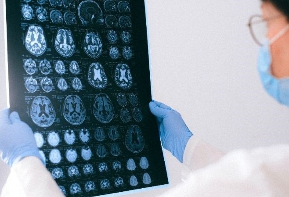 Dünyada ilk: 13 yaşlı uşaq ölümcül beyin xərçəngindən tamamilə xilas olub
