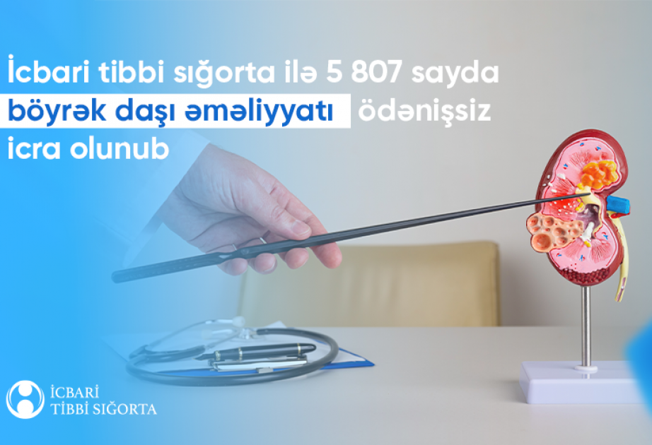 Böyrək daşlarının kəsiksiz xaric edilməsi icbari tibbi sığortaya daxildir
