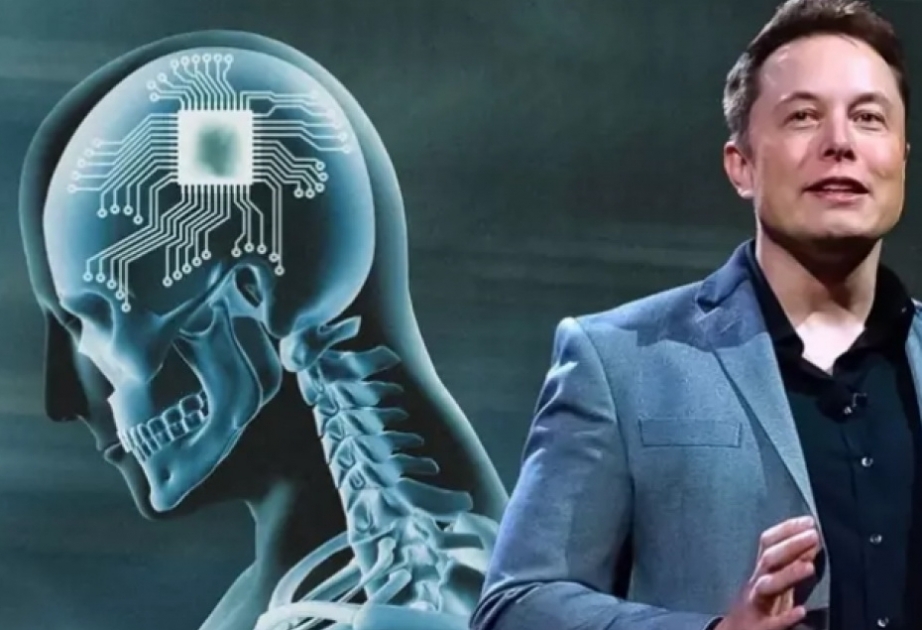 Elon Musk's Neuralink Has Implanted Its First Chip in a Human