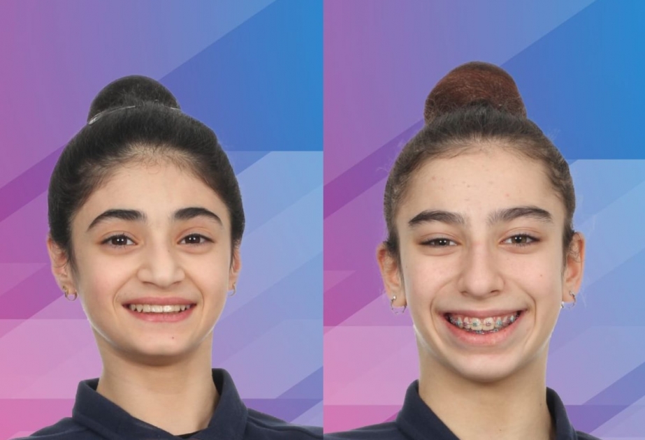 Azerbaijani gymnasts claim two medals at Gymnastic International 2024
