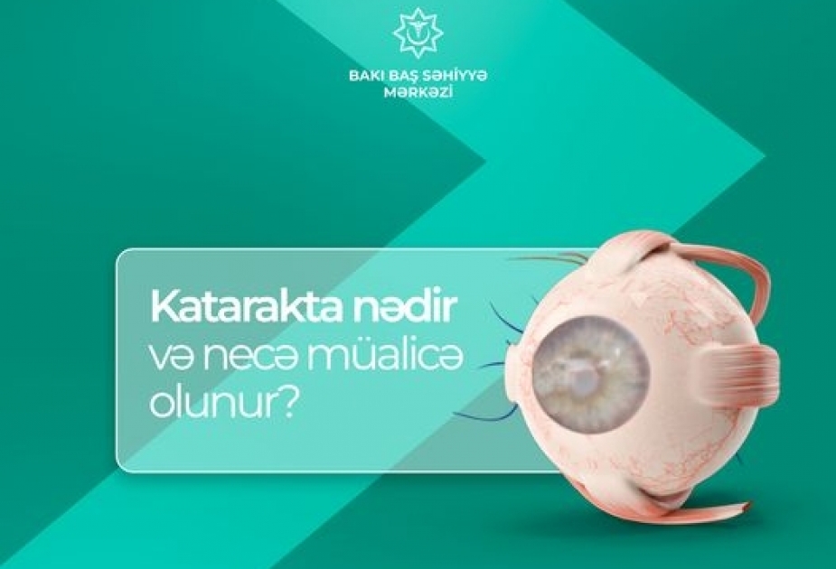 Mütəxəssis: Kataraktanın yeganə müalicəsi cərrahi əməliyyatdır
