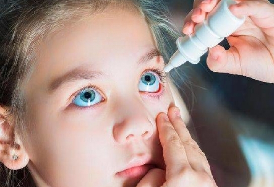 Ekspertdən xəbərdarlıq: Allergik konyunktivit uşaqlıqdan başlayır