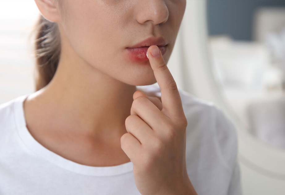 Alimlər herpes virusunun sinir sisteminə necə daxil olmasını araşdırıblar