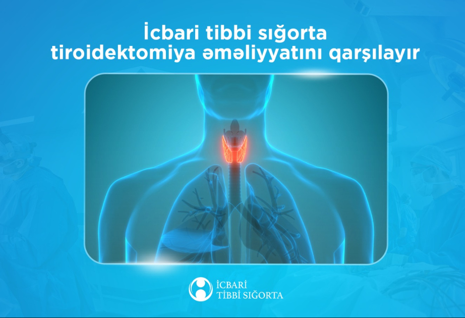 Tiroidektomiya əməliyyatı icbari tibbi sığorta ilə ödənişsizdir