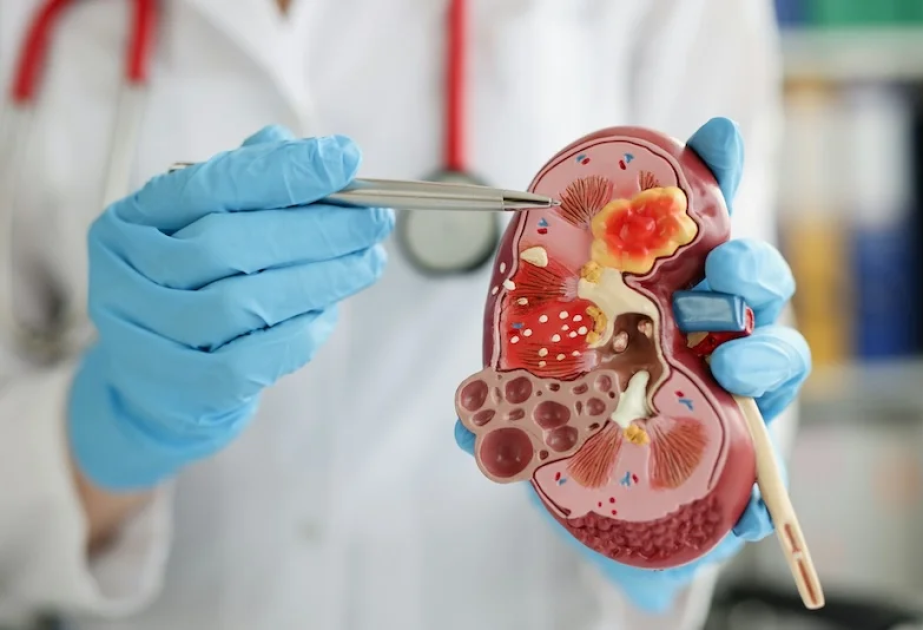 Vitamin B2 xroniki böyrək iltihabının müalicəsinə kömək edə bilər – tədqiqat