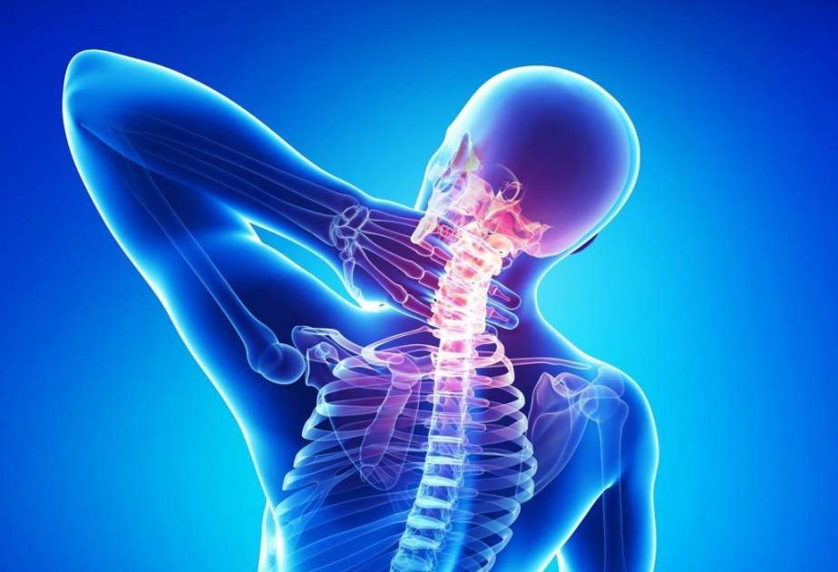 Fizioterapevt: Osteoxondrozdan tam sağalmaq mümkün deyil