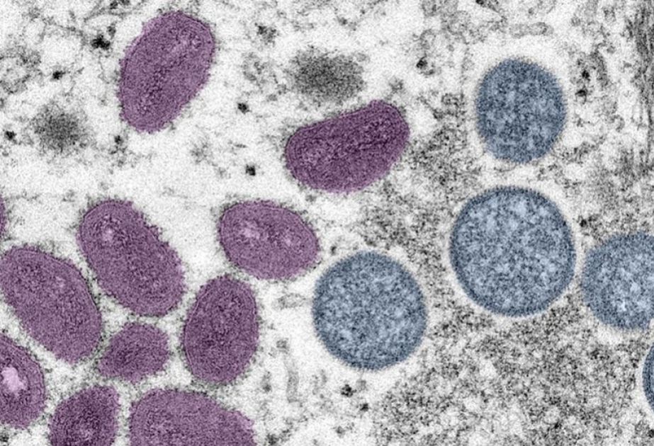 L’OMS s’inquiète d’une hausse sans précédent des cas de mpox en Afrique