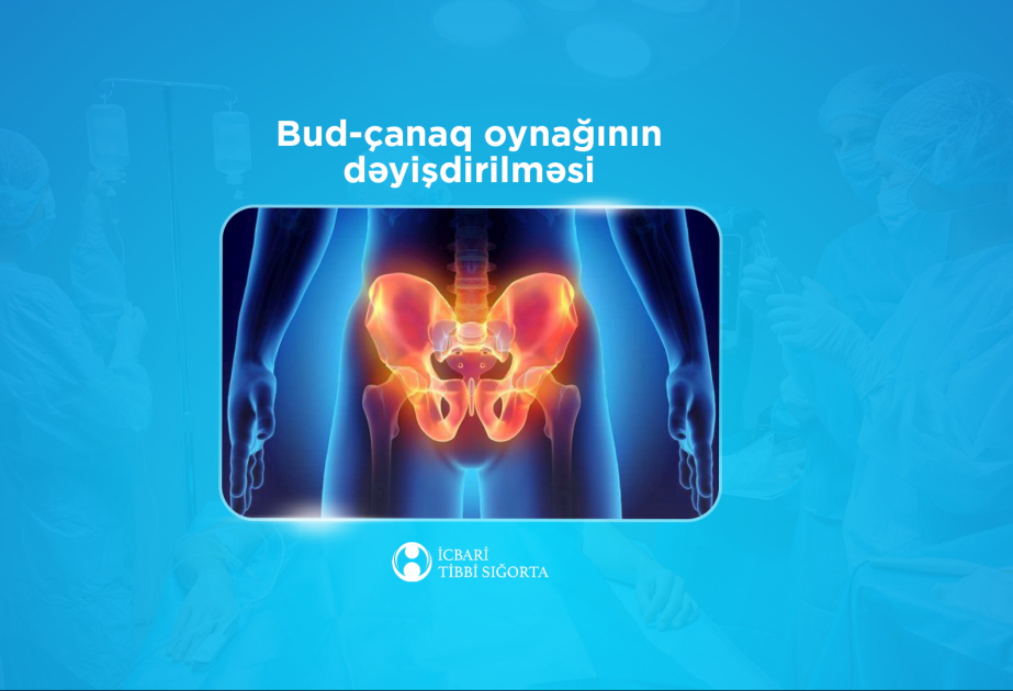 İcbari tibbi sığorta bud-çanaq oynağının süni protezlə dəyişdirilməsi əməliyyatını qarşılayır