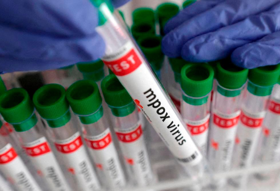 İordaniyada “mpox” virusuna 2024-cü ildə ilk yoluxma halı qeydə alınıb