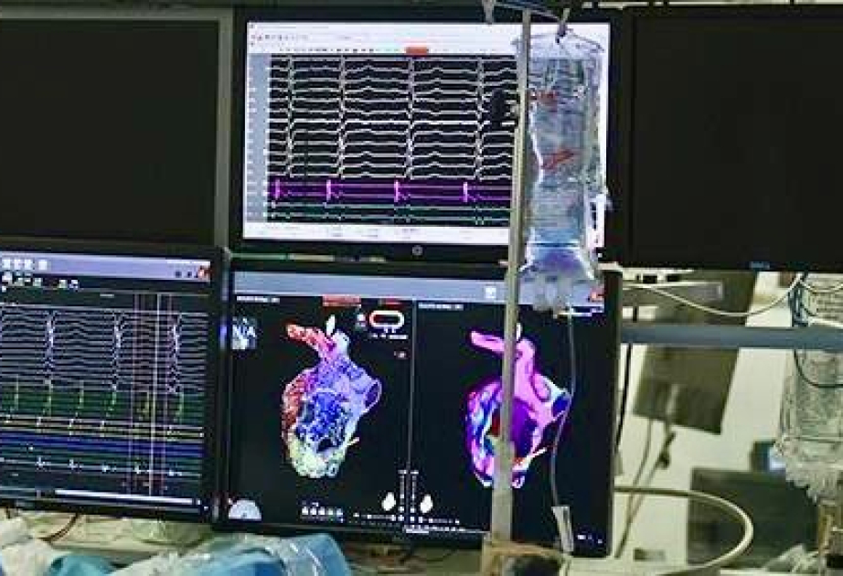 Ürəyin “kiçik beyni”nin 3D xəritəsi hazırlanıb -  ARAŞDIRMA