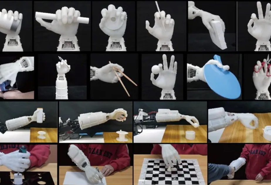 China Focus: Chinese research team develops groundbreaking prosthetic hand