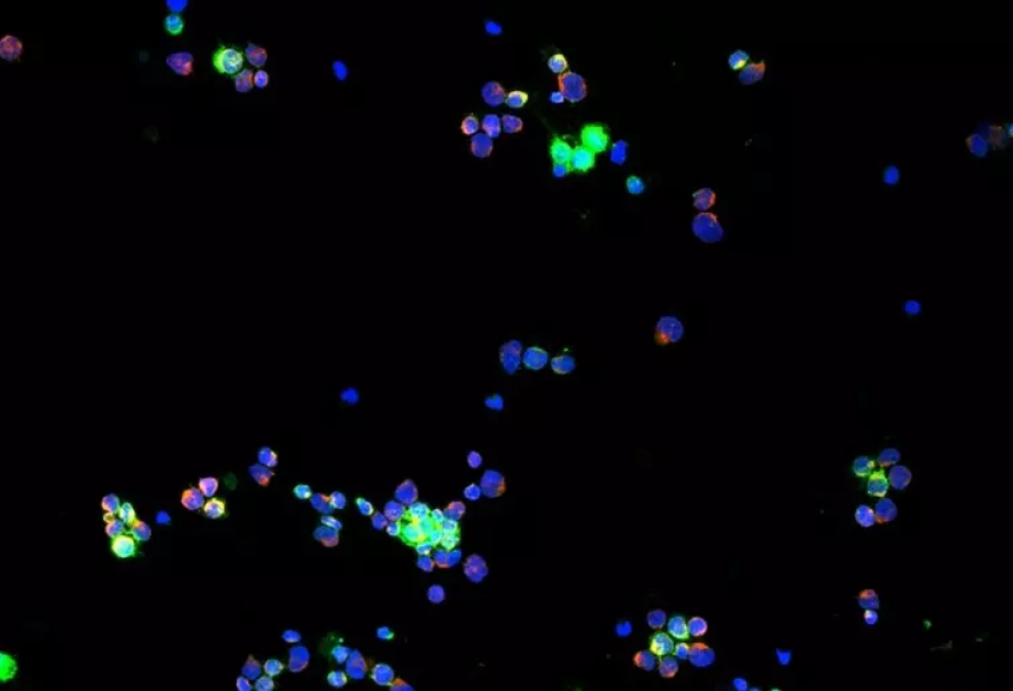 Driver of aggressive tumours discovered, pancreas first