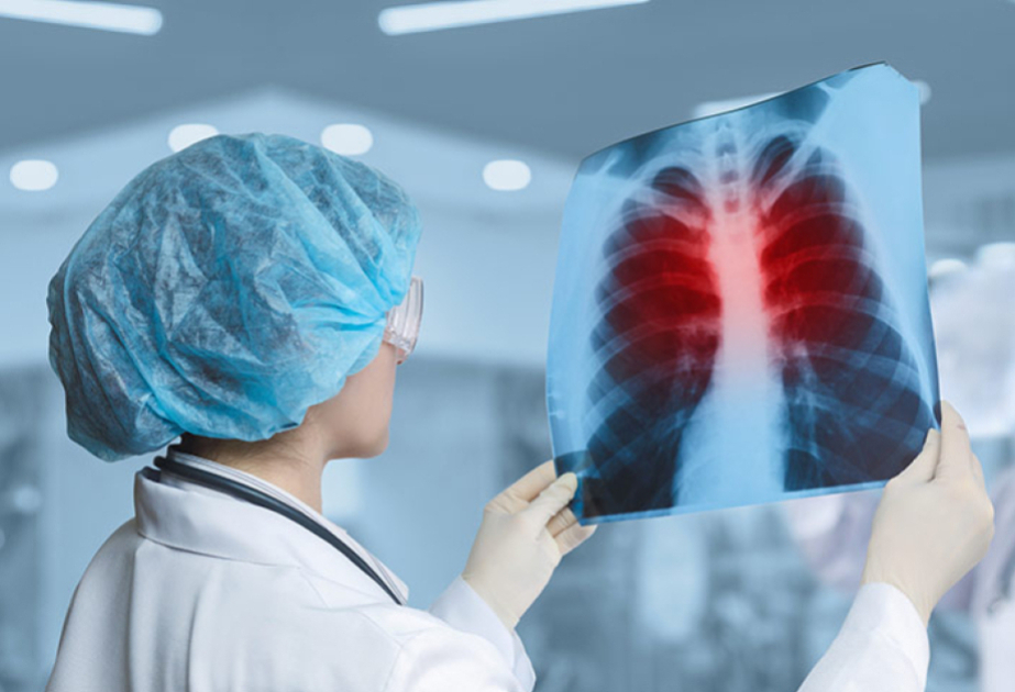 L’OMS s’inquiète d’une hausse des cas de tuberculose infantile en Europe et en Asie centrale