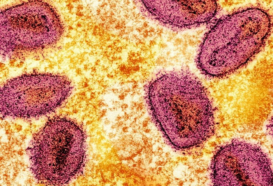 Hohes Pandemierisiko: Virologen warnen vor ernster Bedrohung durch Affenpocken