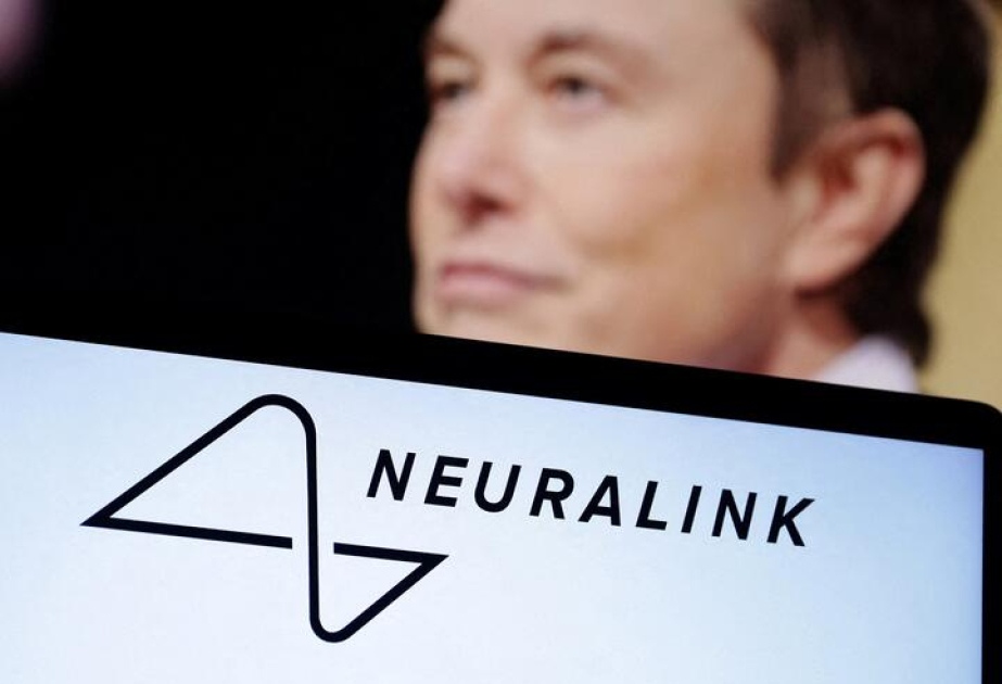 Neuralink начала поиск добровольцев для вживления чипов в мозг по всему миру