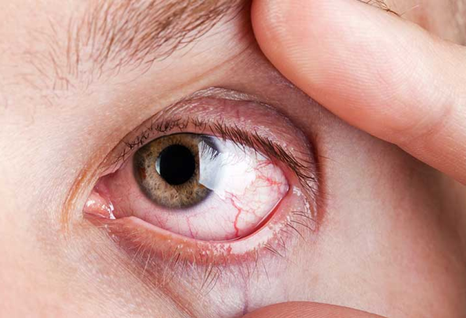 Eye health linked to dementia risk