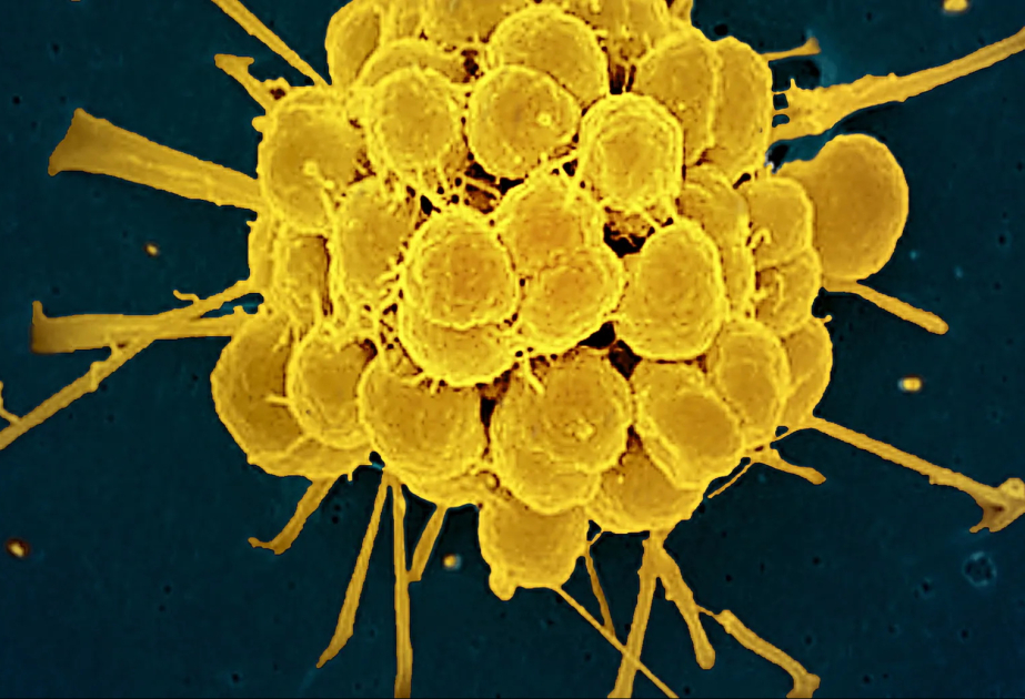 Neu entwickeltes Antibiotikum wirkt gegen resistente Tripper-Erreger