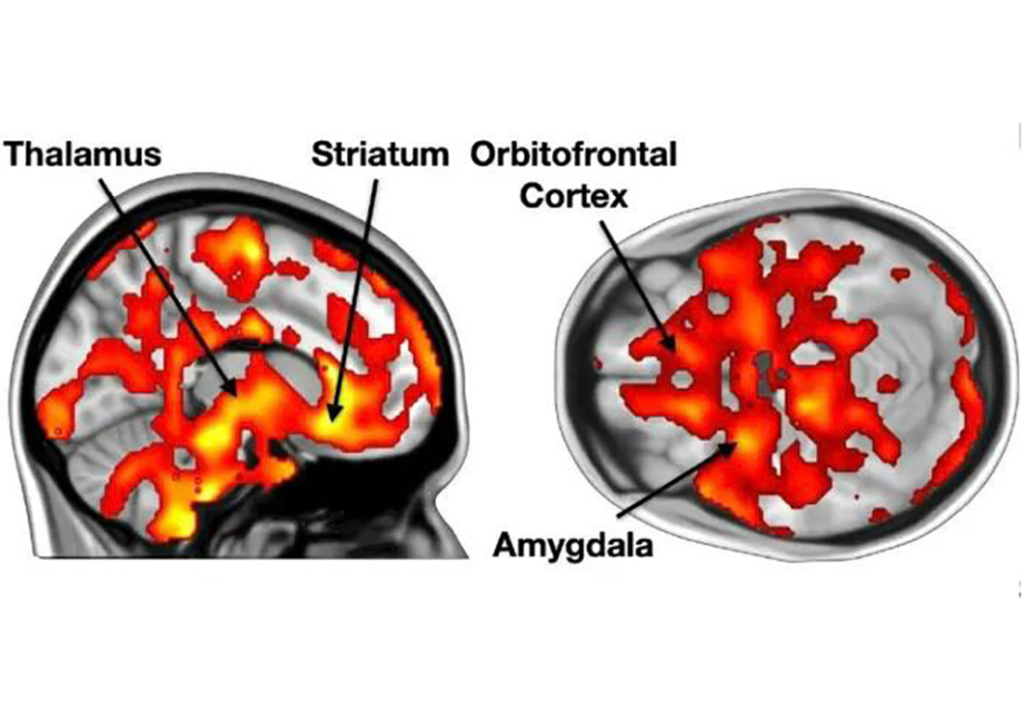 Sevimli musiqinin beynin opioid sistemini aktivləşdirdiyi sübut olunub - TƏDQİQAT