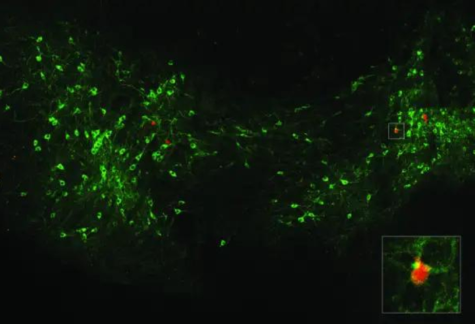 Dopamine signals when a fear can be forgotten, study shows