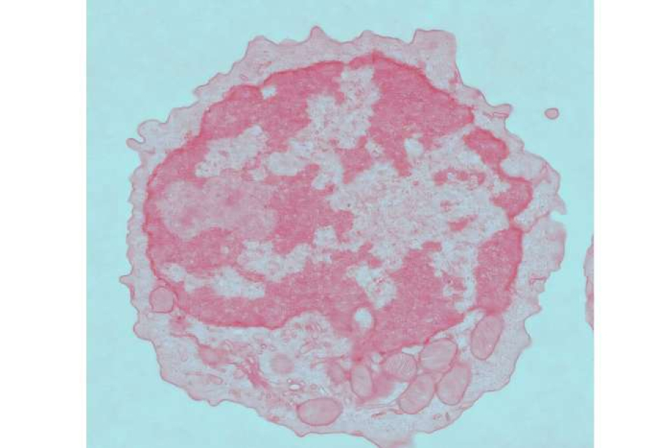 Aging reduces CAR-T cell effectiveness by impairing metabolism, study shows