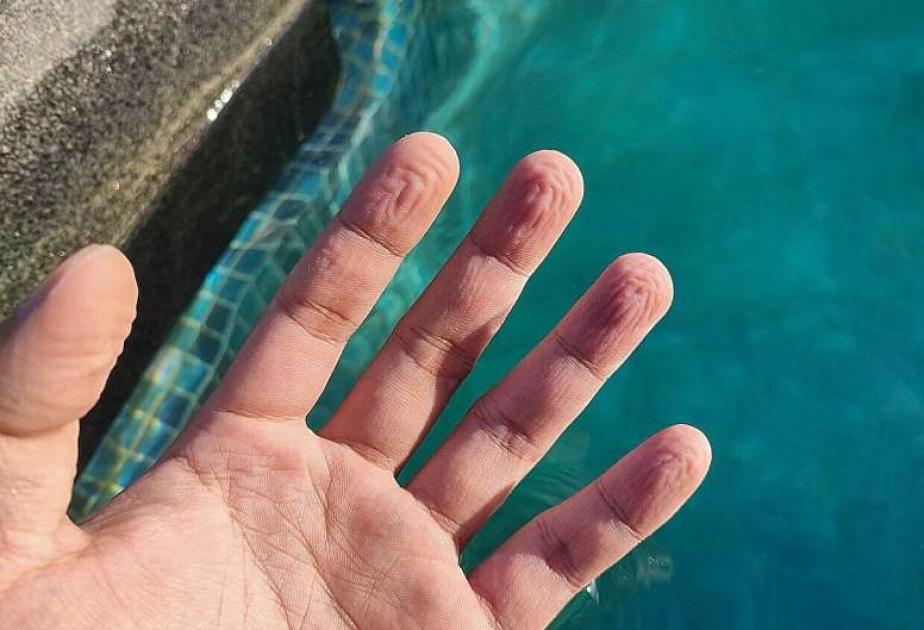 Got pruney fingers? Here's the scientific study to explain it