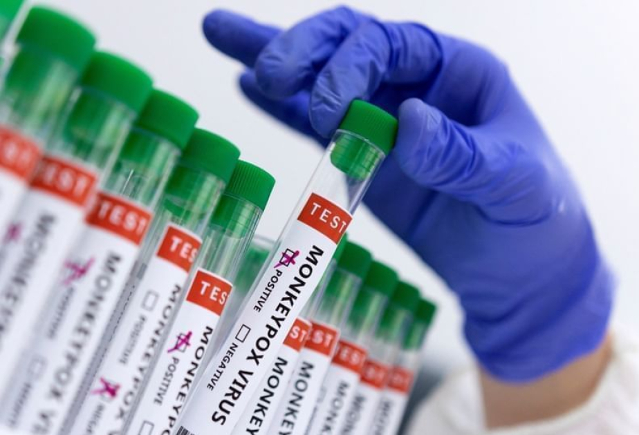 Ghana reports 45 monkeypox cases in past month