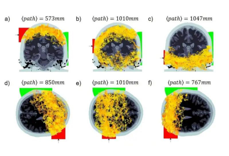 Scientists detect light passing through entire human head, opening new doors for brain imaging