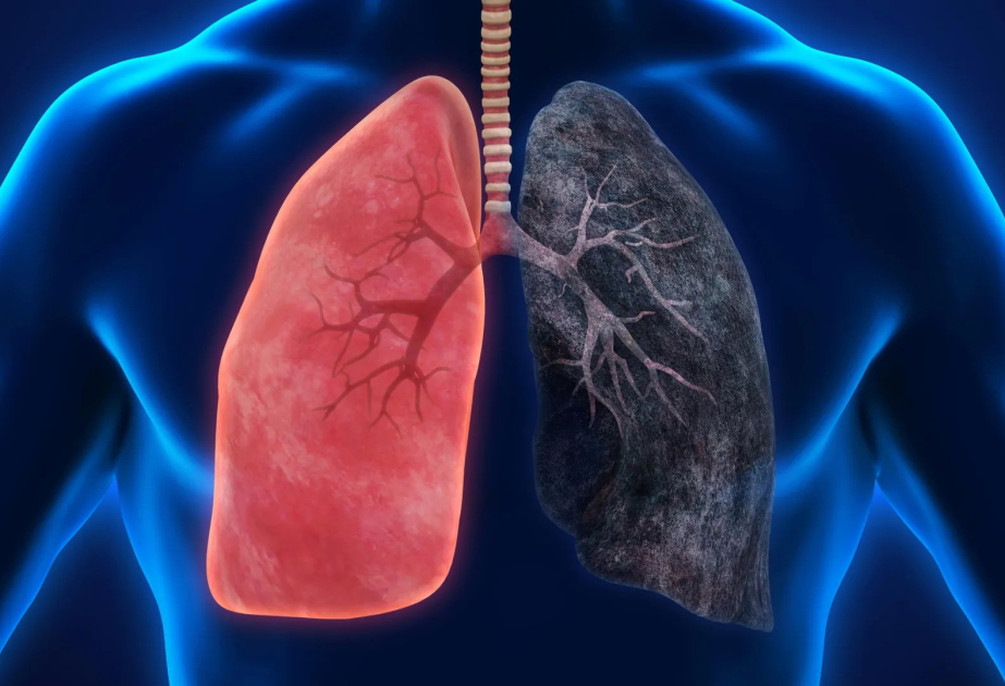Fire smoke exposure leaves toxic metals and lasting immune changes