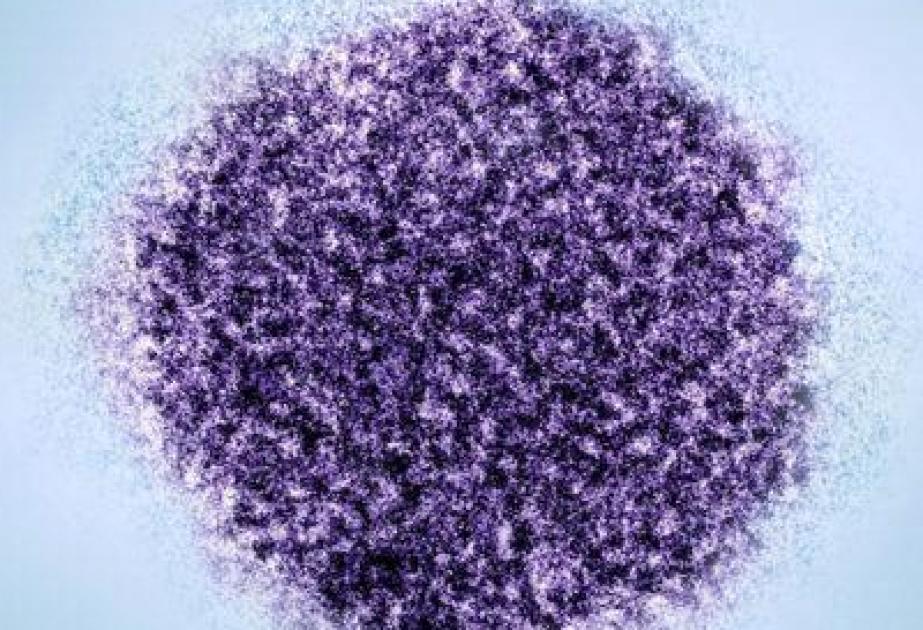 Virus traces discovered in brain lining of people with schizophrenia