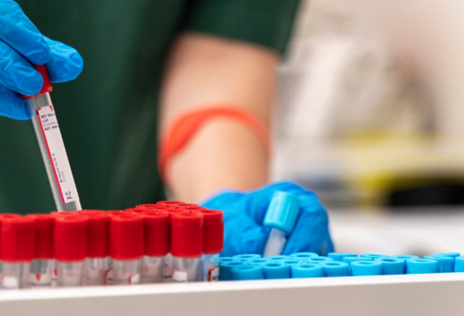 İnfeksionist: Antiretroviral müalicə İİV-ə yoluxan şəxslərdə həyat keyfiyyətini yüksəldir